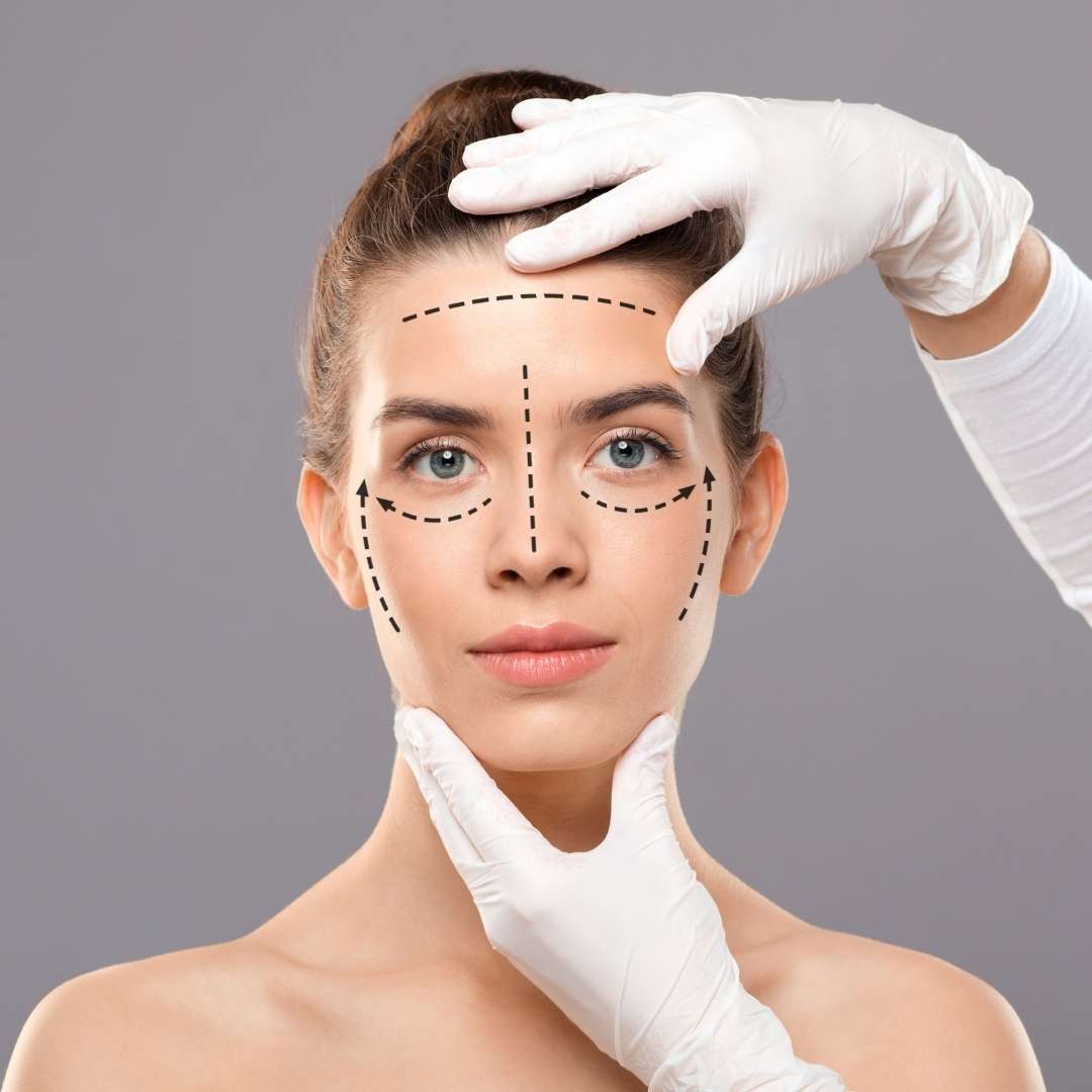 Facelift Surgery