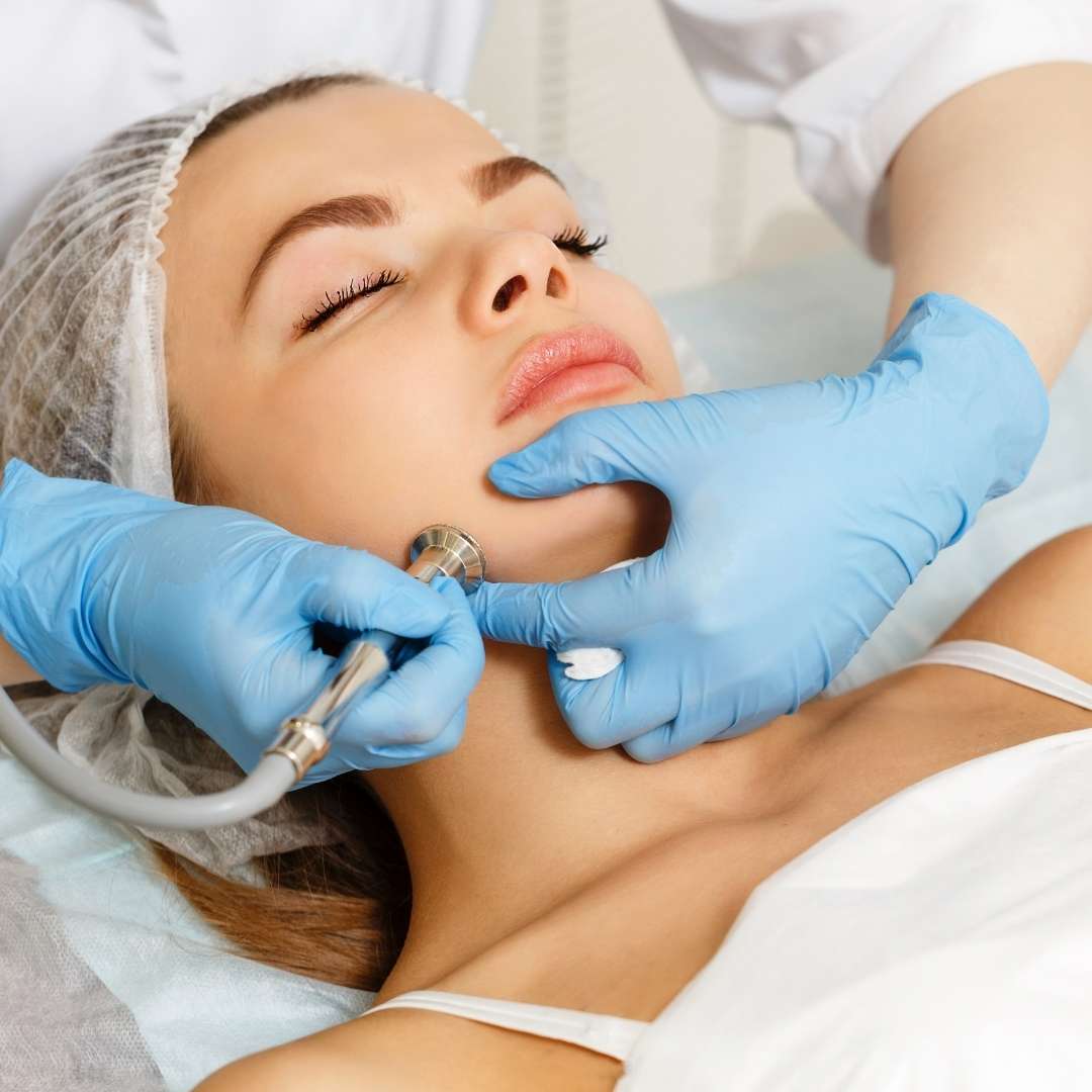 Dermabrasion