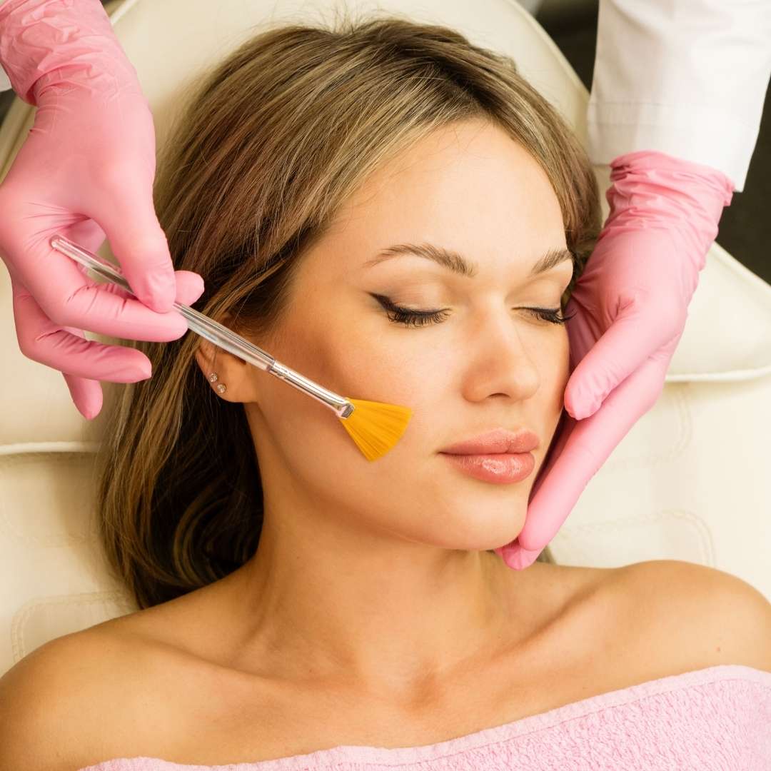 Chemical Peel Improves Skin Texture and Increase Facial Glow
